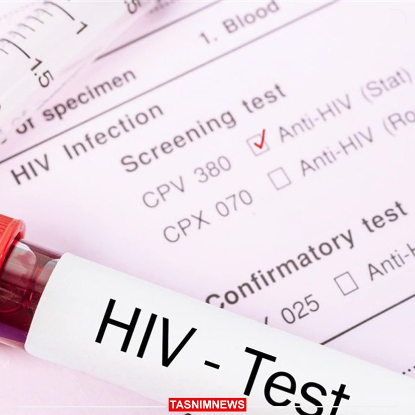 شناسایی بیش از ۲۴۰۰۰ بیمار HIV در ایران